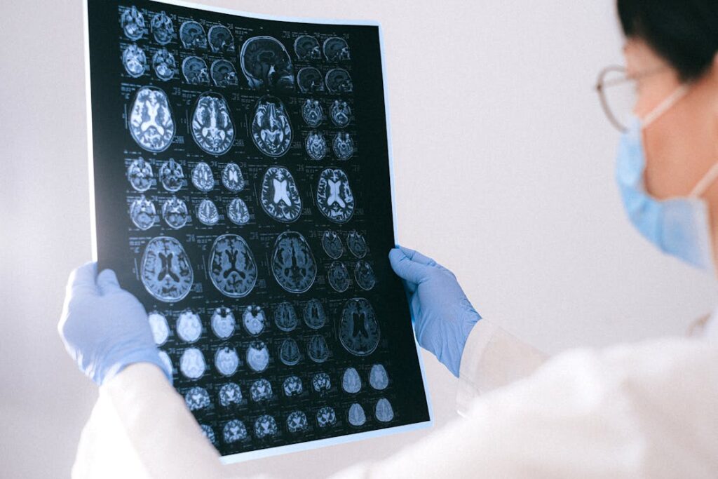 Descubren mecanismo clave en tumor cerebral infantil que podría abrir la puerta a nuevos tratamientos